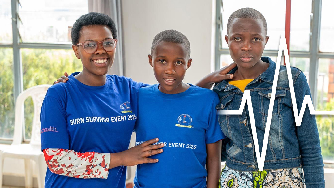 Rwanda – Burn Survivors