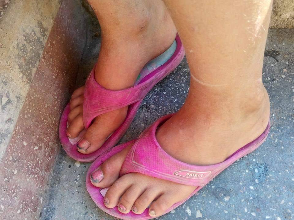 Arad feet 1